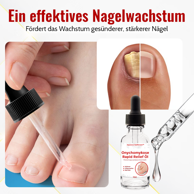 Japansk NailRenew™ Olje Mot Onykomykose (1+1 gratis!)